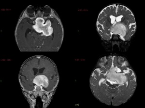 Image from Jacob et al 2010
